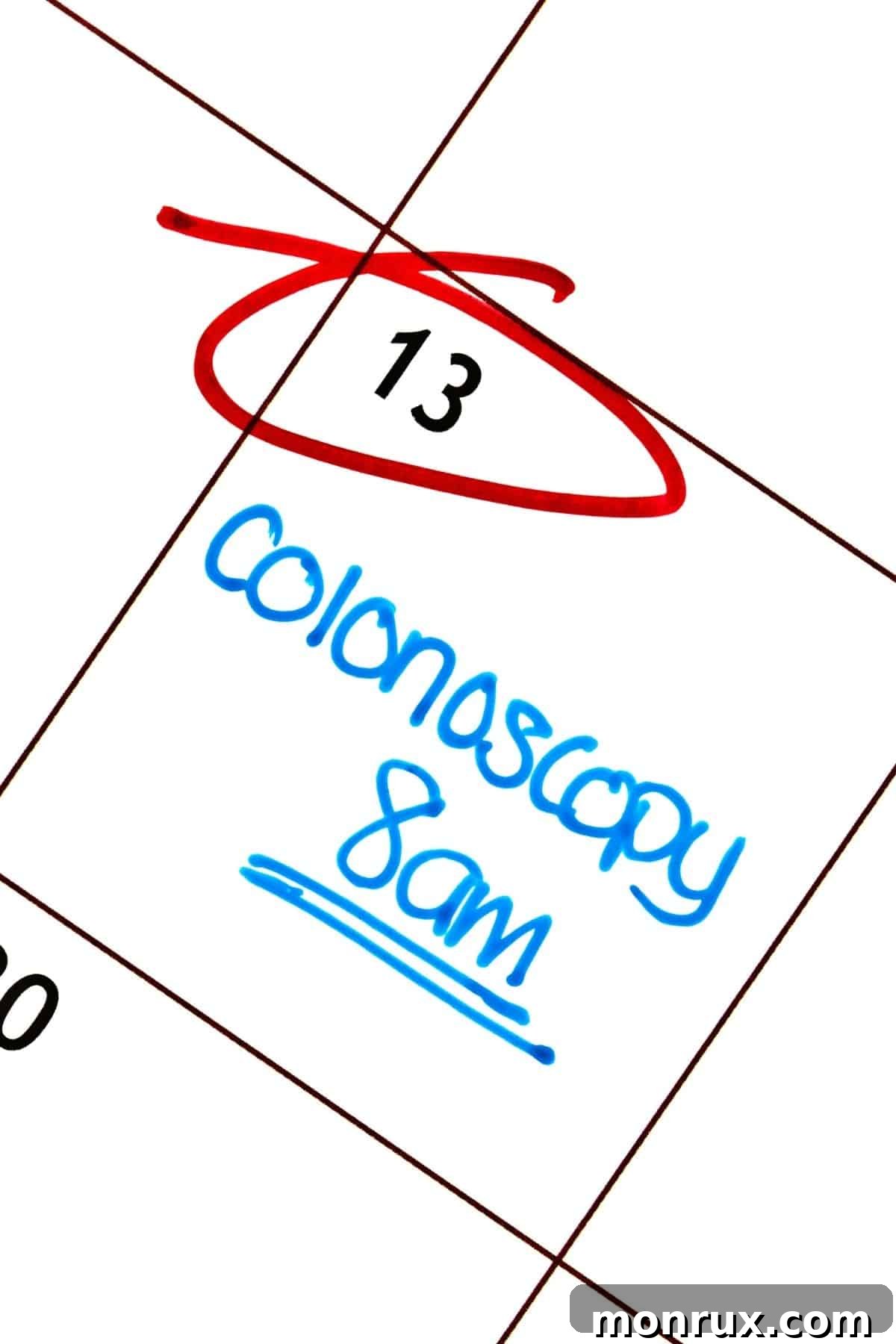 Calendar displaying 'Colonoscopy' appointment, symbolizing an important health check-up.