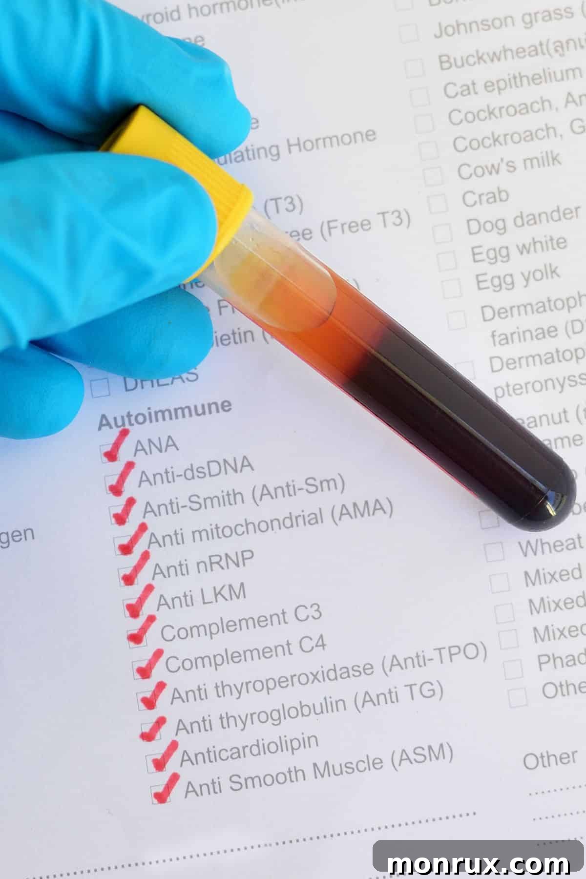 A person holding a vial over an autoimmune checklist, symbolizing the journey of managing autoimmune conditions through dietary changes.