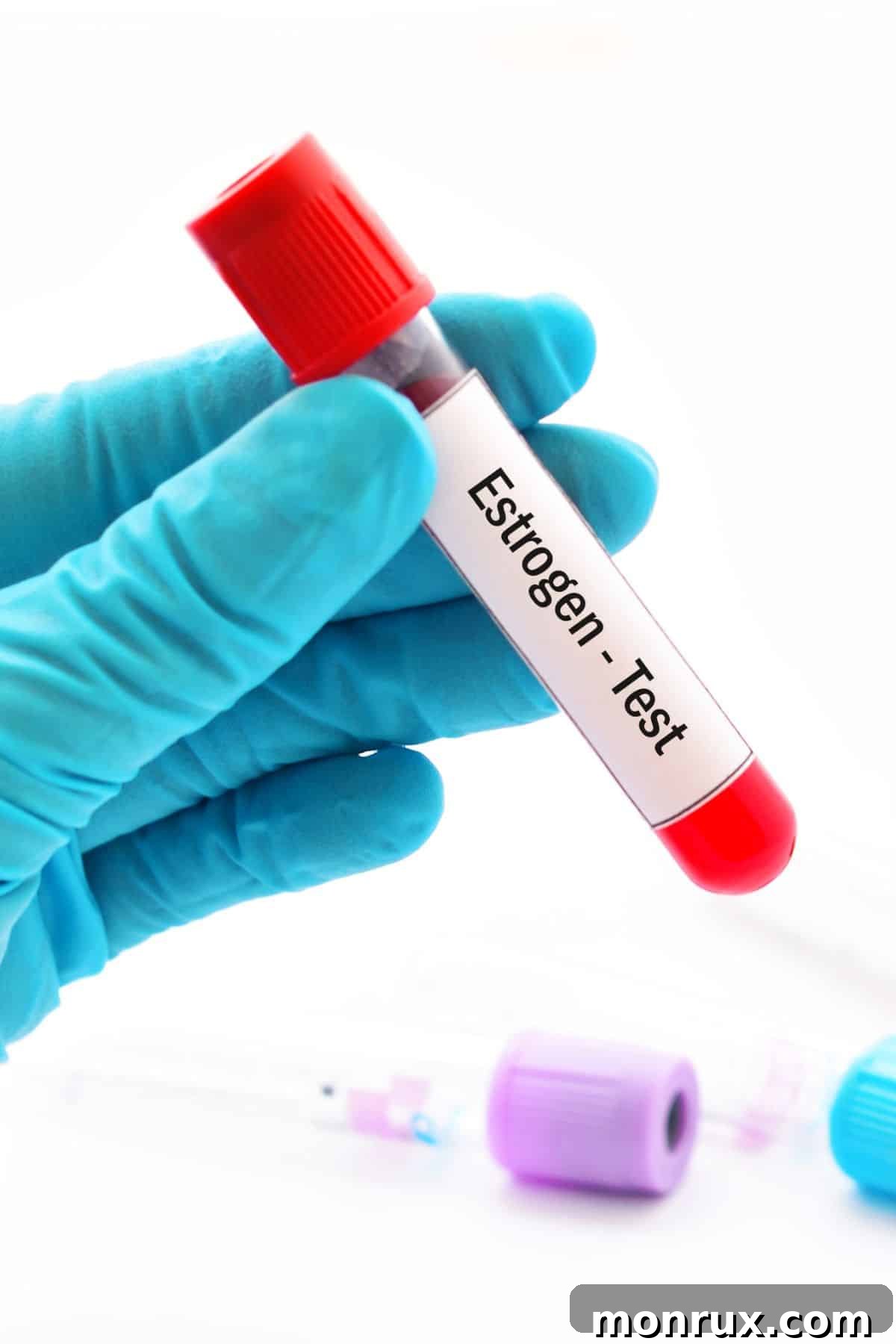 A person holds a test tube labeled "Estrogen-Test", symbolizing hormonal health awareness.