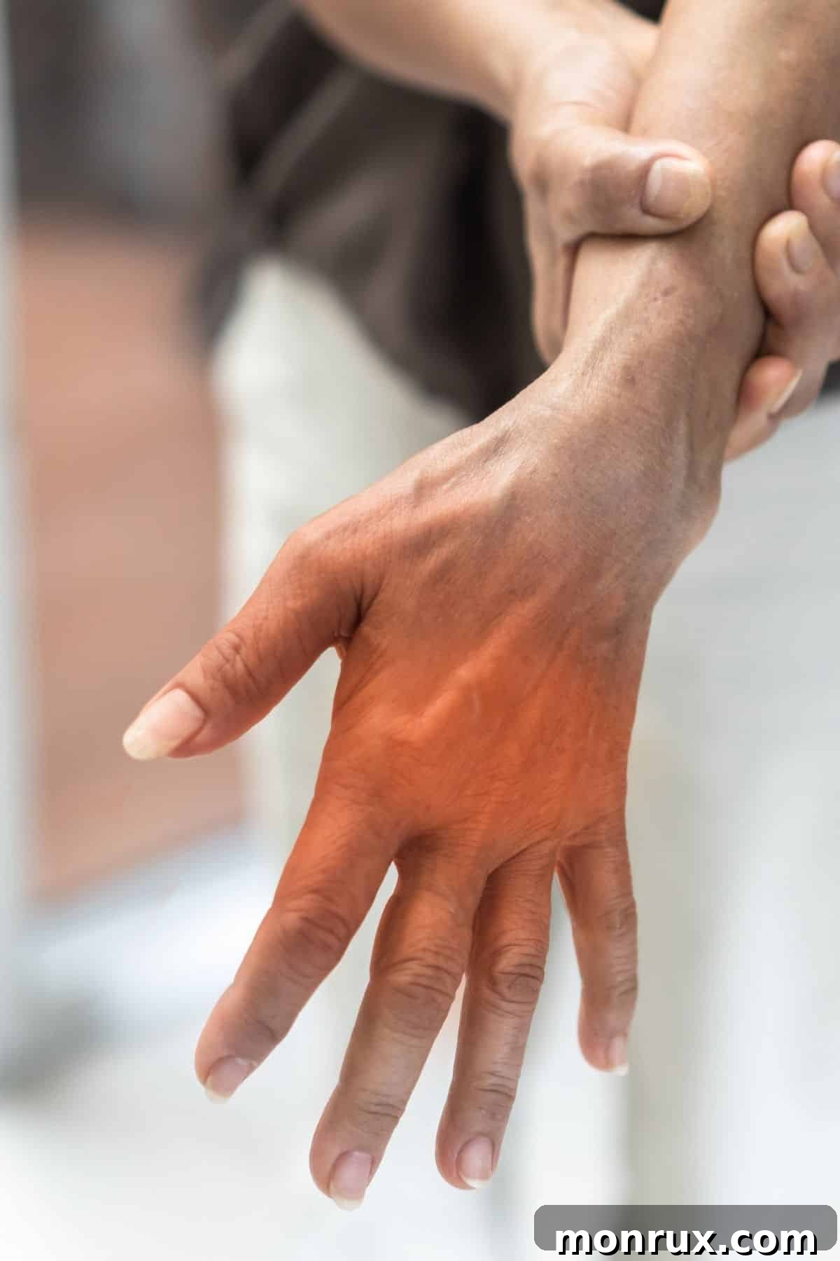 A woman holding her hand, possibly indicating nerve pain or discomfort in the hand.